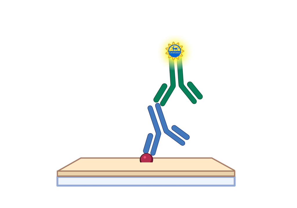 2019 nCoV(S) ELISA, COVID-19